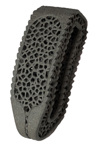 Titanium-Zirconium-Molybdenum Powder Spinal Implant